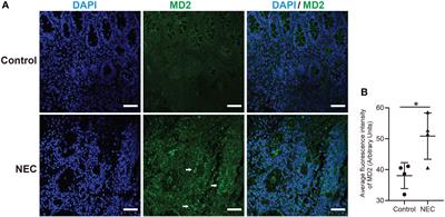 Selective targeting of MD2 attenuates intestinal inflammation and prevents neonatal necrotizing enterocolitis by suppressing TLR4 signaling